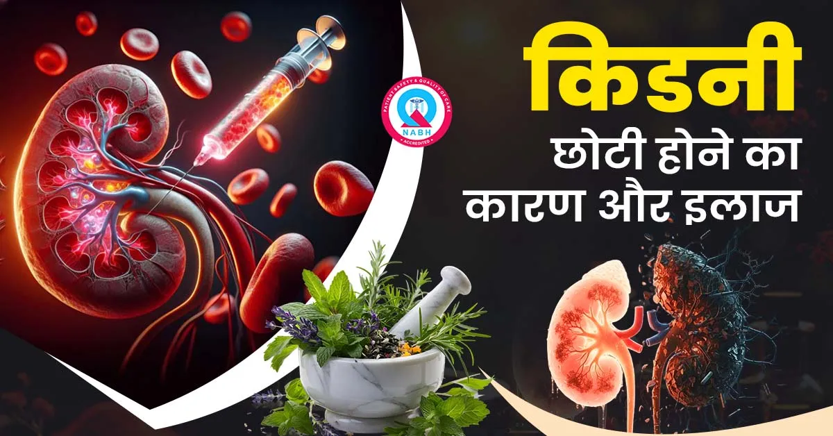 किडनी-छोटी-होने-का-कारण-और-इलाज